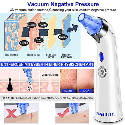 Aspiradora de poros removedora de puntos negros, limpiador de poros con succión facial, herramienta extractora eléctrica de puntos negros con 5 succión, 4 sondas, removedor de succión de puntos negros para mujeres y hombres (azul)